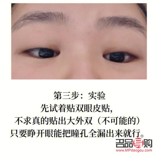 <h3>解决单眼皮肿眼泡的有效方法</h3>