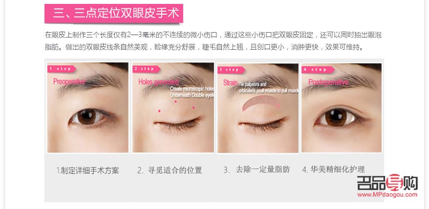 <h3>探索纳米无痕双眼皮3D视频的奇妙世界</h3>