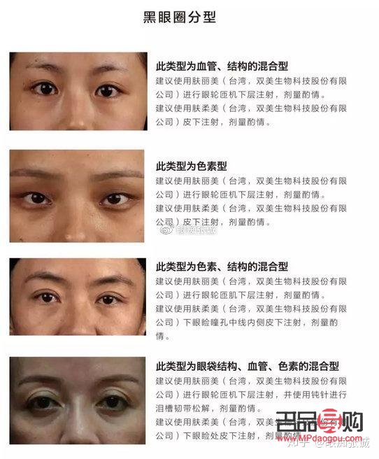 深圳去除眼袋黑眼圈哪里最好(深圳去除眼袋黑眼圈哪里最好的医生)