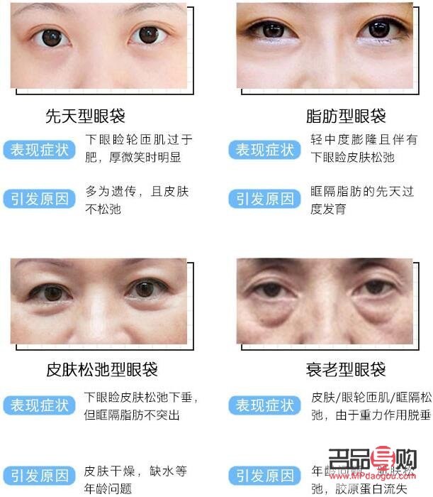 眼袋贴去眼袋有用吗(眼袋贴去眼袋有用吗多少钱)