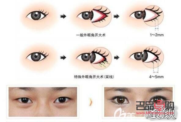 外眼角很大属于什么眼型