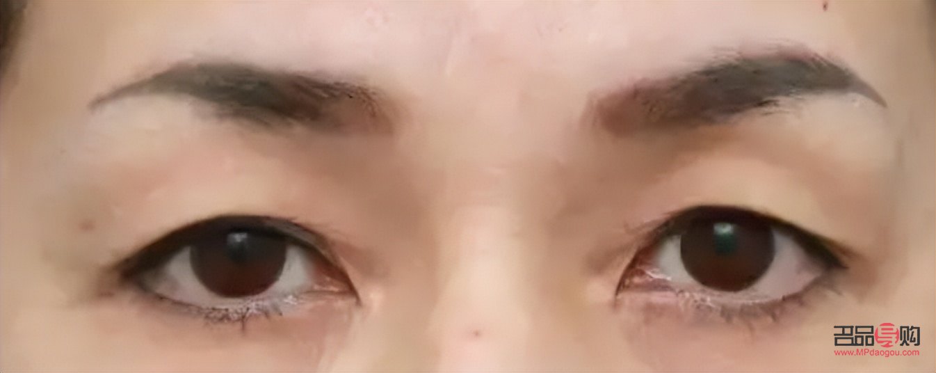 眼皮下垂怎么自然恢复(眼皮下垂怎么自然恢复小妙招)