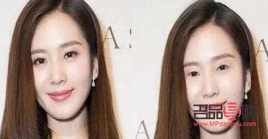 单眼皮变双眼皮(单眼皮变双眼皮了怎么回事)