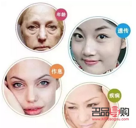 眼袋的克星是什么药膏(眼袋大是身体哪里出现了问题)