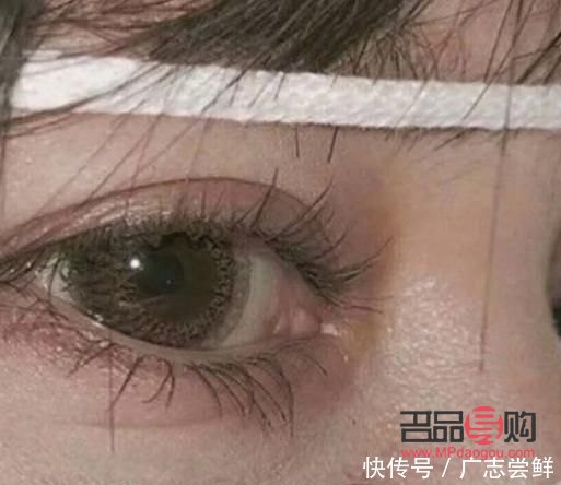 天生肿眼泡怎么按摩可以变薄(天生肿眼泡怎么按摩可以变薄一点)