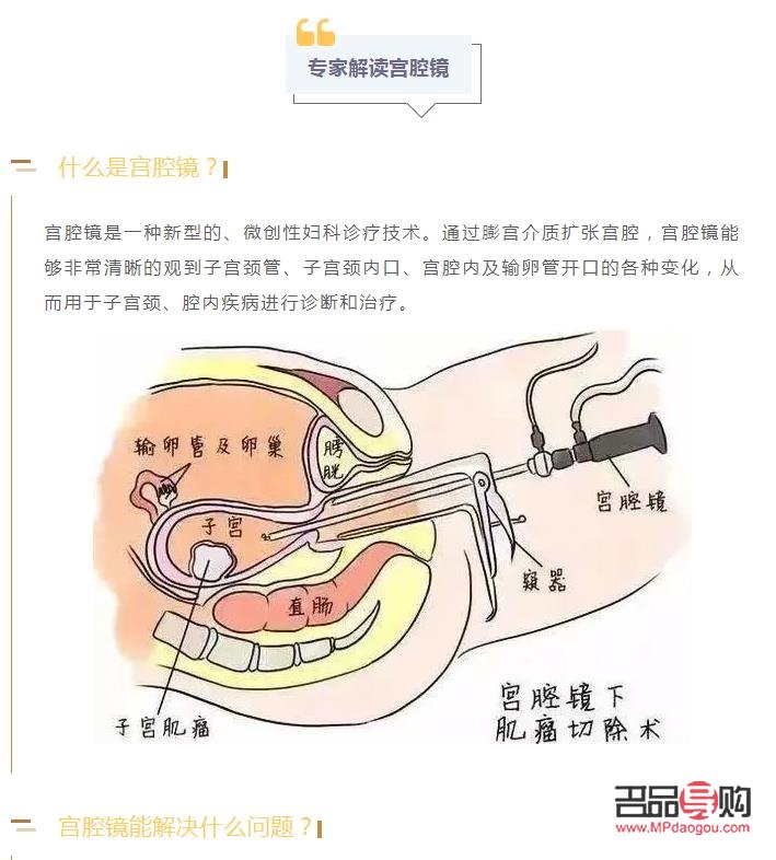 <h3>刮宫后身体护理全攻略</h3>