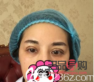 西安市做双眼皮哪家好(西安市做双眼皮哪家好一点)