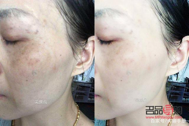 <h3>美容院能否有效去除肌肤暗黄？</h3>