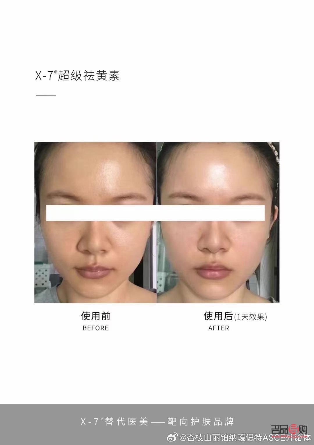 美容院能否有效去除肌肤暗黄？