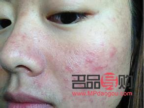 干性皮肤身体怎么护理(干性皮肤身体怎么护理最好)