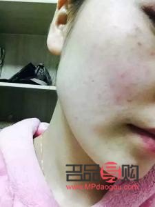 如何查彩妆过敏(如何查彩妆过敏原因)