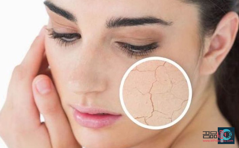 <h3>身体干燥起皮,呵护肌肤有妙招</h3> <h3>身体干燥起皮,呵护肌肤有妙招</h3>