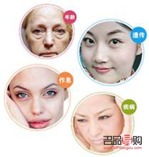 一只眼睛下眼睑突然肿了图片(一只眼睛下眼睑突然肿了图片女)