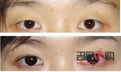 双眼皮图片类型(双眼皮图片类型大全)