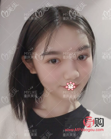 双眼皮图片类型(双眼皮图片类型大全)