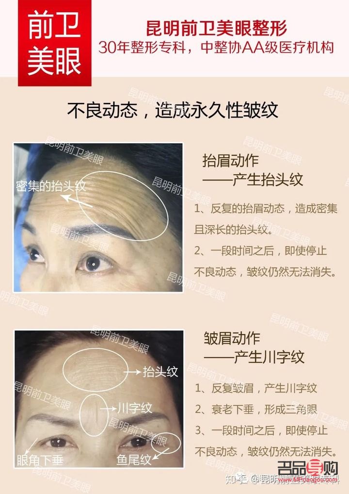 <h3>眼部打营养针，除皱效果究竟如何？</h3>