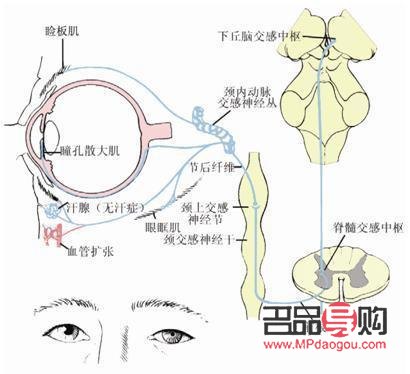<h3>眼周神经痉挛的治疗方法</h3> <h3>眼周神经痉挛的治疗方法</h3>