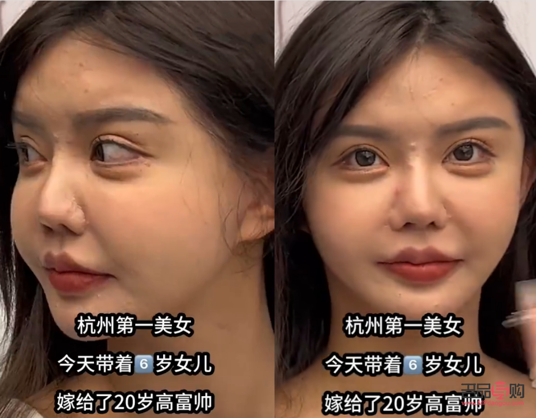 <h3>一只眼睛卧蚕肿胀原因及应对方法</h3>