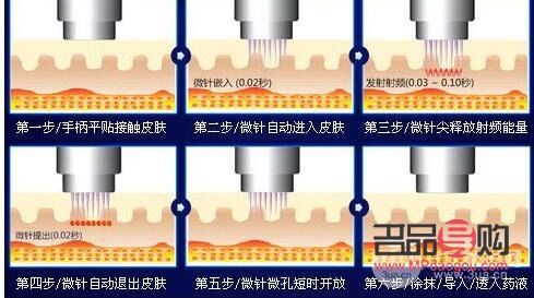 <h3>微针后的身体护理全攻略</h3>