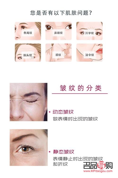 <h3>探寻去眼下皱纹的费用之谜</h3>