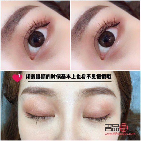 双眼皮的多样眼型图解 双眼皮的多样眼型图解