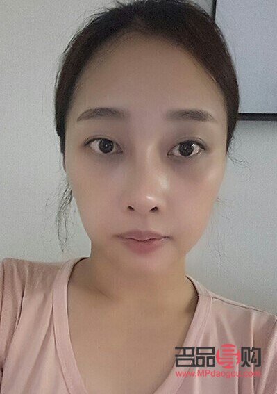 割双眼皮有哪几种眼型(割双眼皮有哪几种眼型好看)