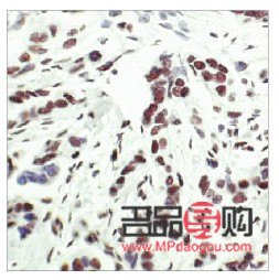 <h3>送礼之选：帽子，是否适宜赠送？</h3>