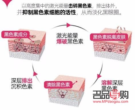 眼部黑色素代谢不出来怎么办(黑眼圈激光一次多少钱)