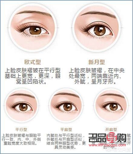 如何变成双眼皮不用割(如何变成双眼皮不用割简单) 如何变成双眼皮不用割(如何变成双眼皮不用割简单)