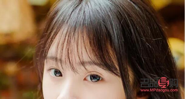 内眦赘皮开眼角对比(内眦赘皮开眼角对比图)