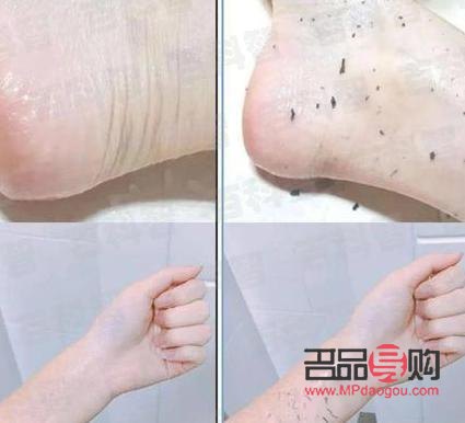 <h3>身体护理搓泥怎么办？教你几招轻松应对！</h3>