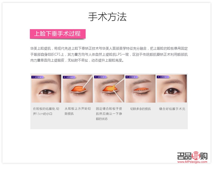 <h3>眼部抽脂手术费用及注意事项</h3>