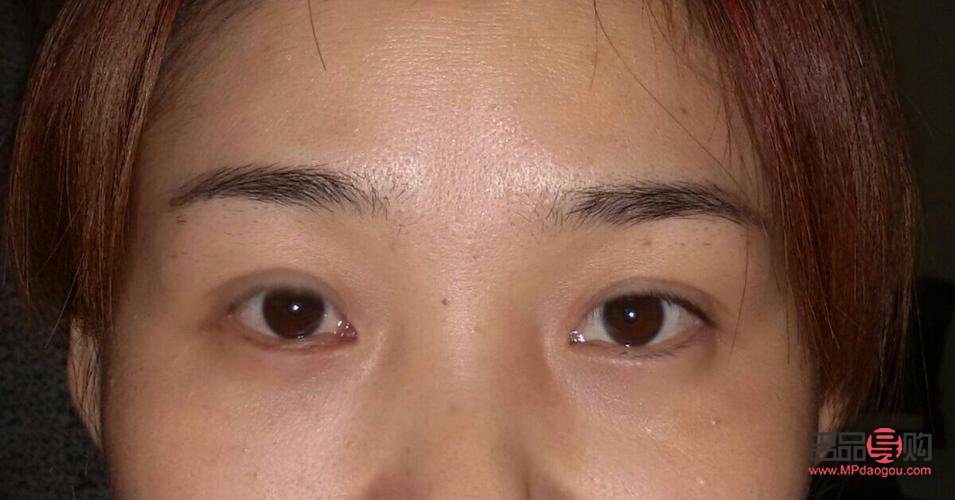 改善眼眶凹陷(改善眼眶凹陷的方法)