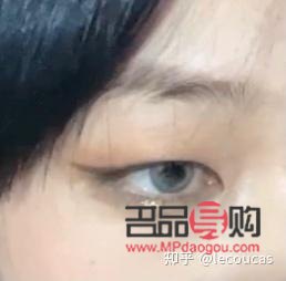 天生肿眼泡怎么治(天生肿眼泡怎么治呀)