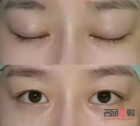 双眼皮的人多还是单眼皮的人多(世界上双眼皮的人多还是单眼皮的人多)