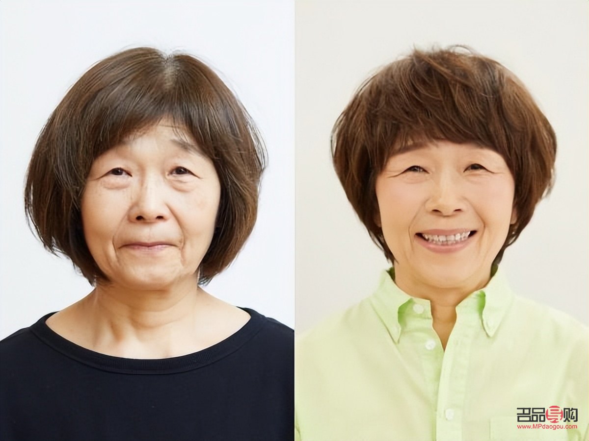 眼角耷拉是什么原因(提升眼角下垂的方法)