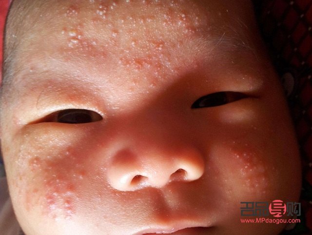 春季身体护理做什么(春季身体护理做什么好)