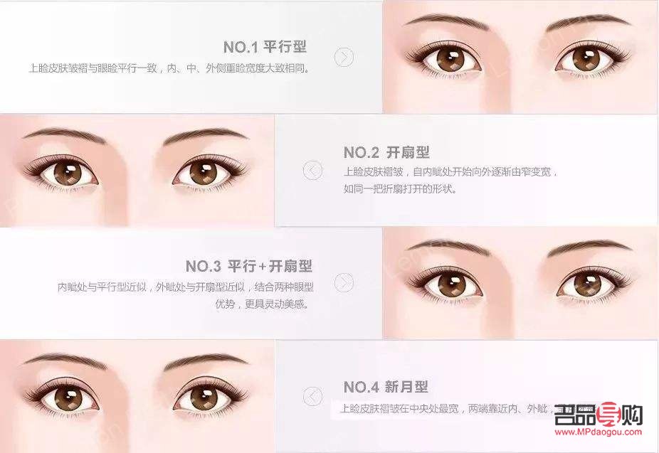 <h3>双眼皮种类图片全解析</h3>