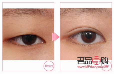 <h3>6D翘睫双眼皮:美丽背后的考量</h3> <h3>6D翘睫双眼皮:美丽背后的考量</h3>