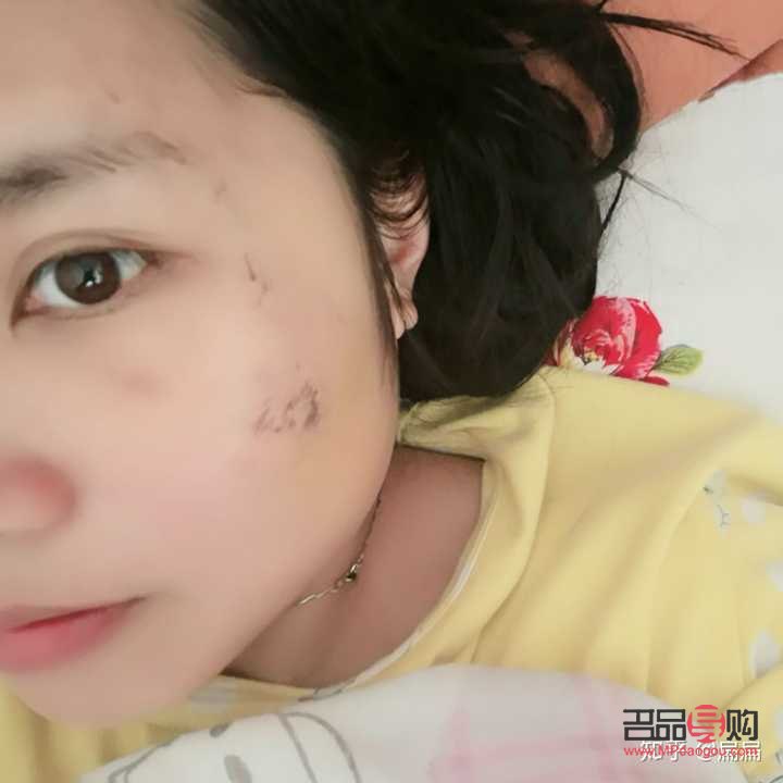 彩妆如何遮疤痕(彩妆如何遮疤痕呢)