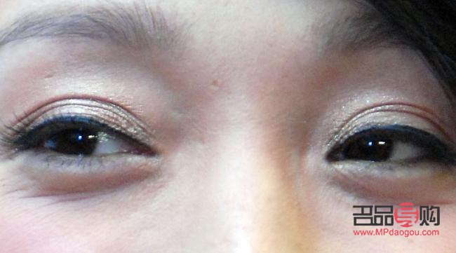 下眼袋处肿了像蚊子包怎么办(下眼袋处肿了像蚊子包怎么办用什么药)