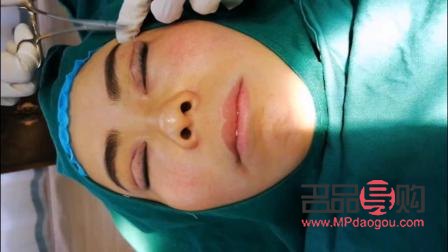 双眼皮做窄了还能加宽吗(双眼皮做窄了还能加宽吗视频)