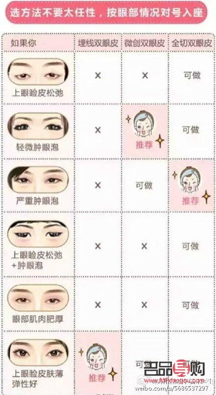 <h3>双眼皮是什么眼睛</h3>