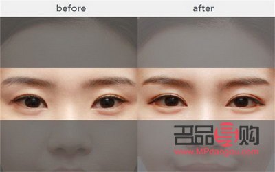 双眼皮是什么眼睛