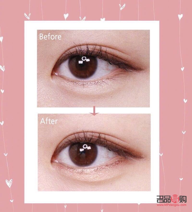 <h3>卧蚕眼：魅力之眼，灵动之韵</h3>