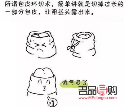 美容包皮手术吗(美容包皮手术吗会复发吗)