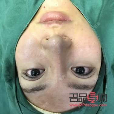 <h3>大小眼手术失败:原因、影响与应对策略</h3> <h3>大小眼手术失败:原因、影响与应对策略</h3>