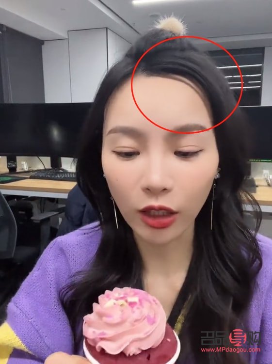 眼窝凹陷可以填充玻尿酸吗(眼窝凹陷可以填充玻尿酸吗视频) 眼窝凹陷可以填充玻尿酸吗(眼窝凹陷可以填充玻尿酸吗视频)