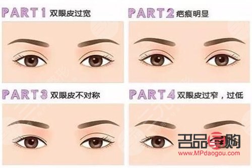 双眼皮图片 效果图女生(双眼皮图片 效果图女生可爱)