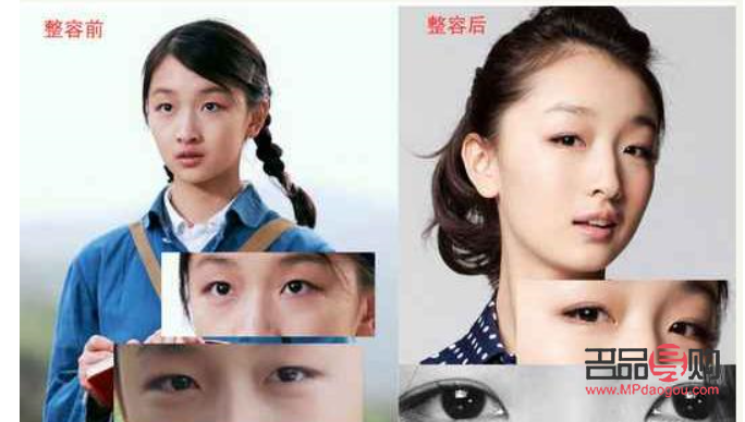 眼皮埋线和割双眼皮有什么区别(眼皮埋线和割双眼皮有什么区别吗)